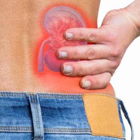 Maladies rénales : L'impact du CBD dans le traitement des problèmes rénaux